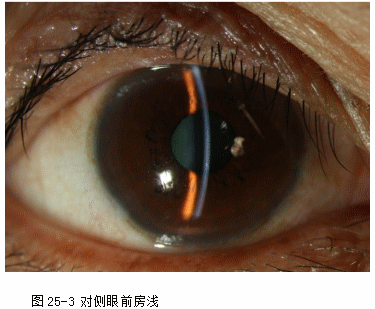 ZY016_130_3.gif